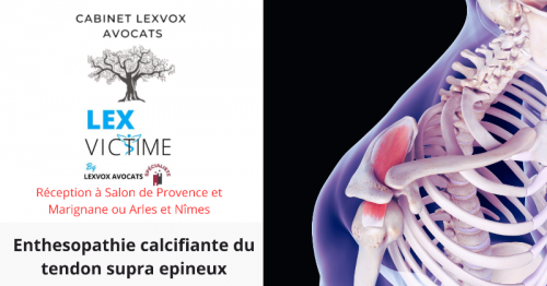 enthesopathie-calcifiante-du-tendon-supra-epineux.png