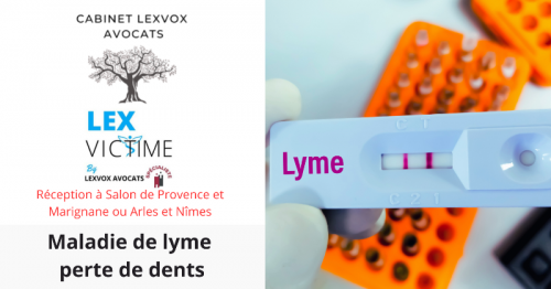 maladie-de-lyme-perte-de-dents.png