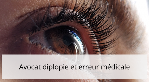 diplopie-et-erreur-medicale-1-.png