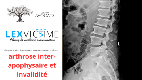 arthrose-inter-apophysaire-et-invalidite.png